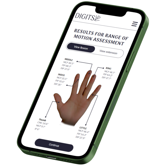 Digits product overview